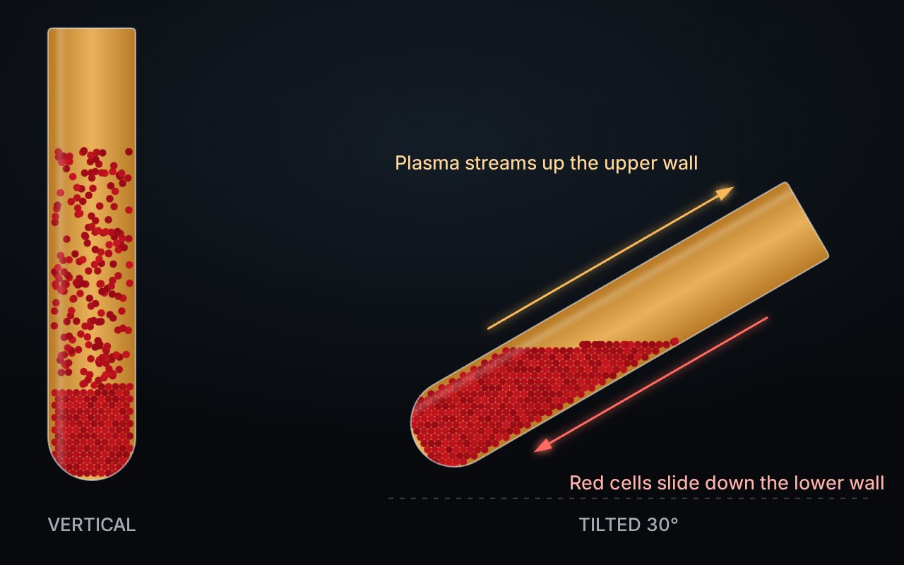 Diagram: in a tube tilted 30 degrees, red cells slide down the lower wall while plasma streams up the upper wall