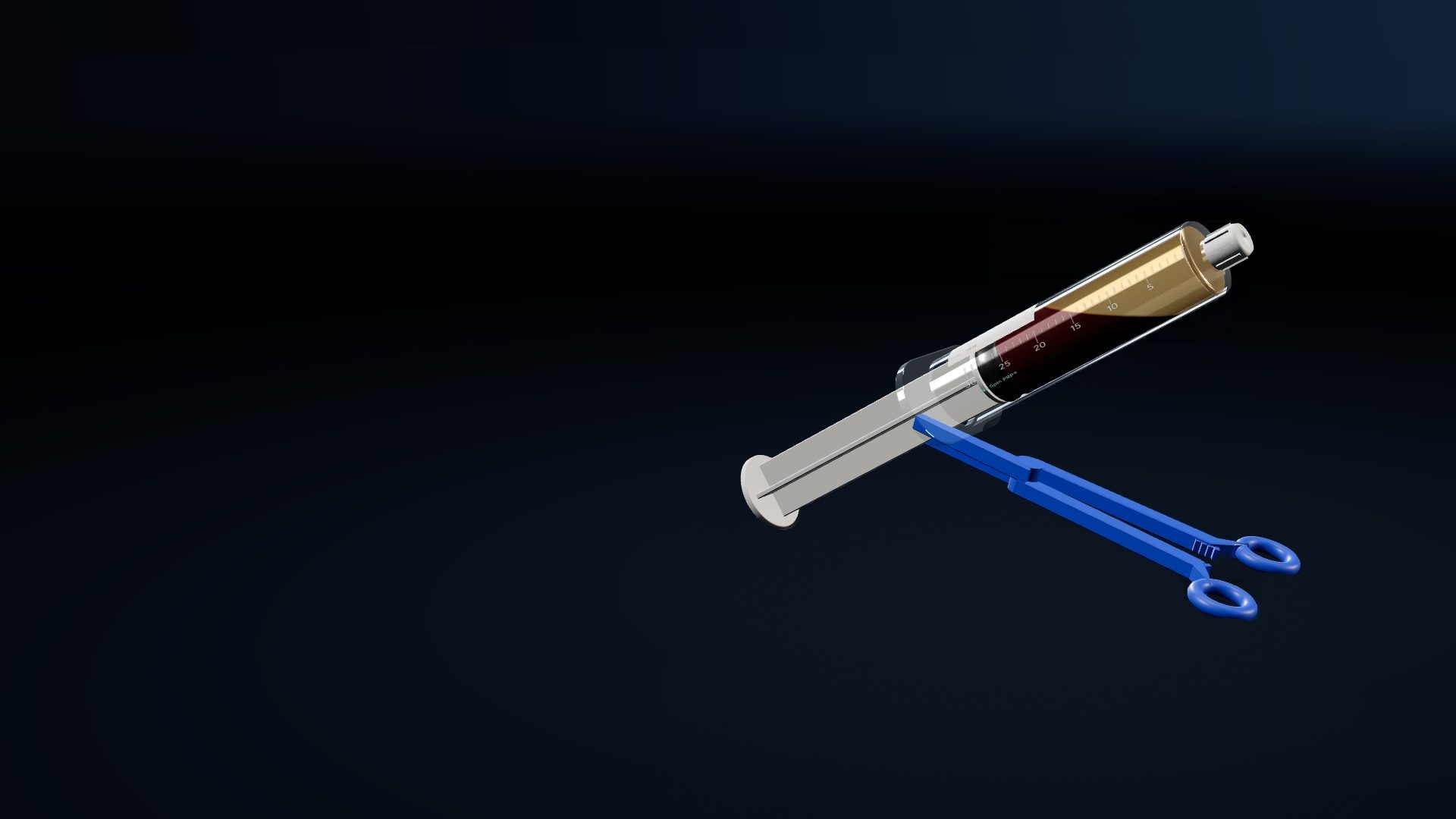 Render: the No Spin PRP processing syringe at rest in its positioning clamp after settling, with a plasma layer above the red cells