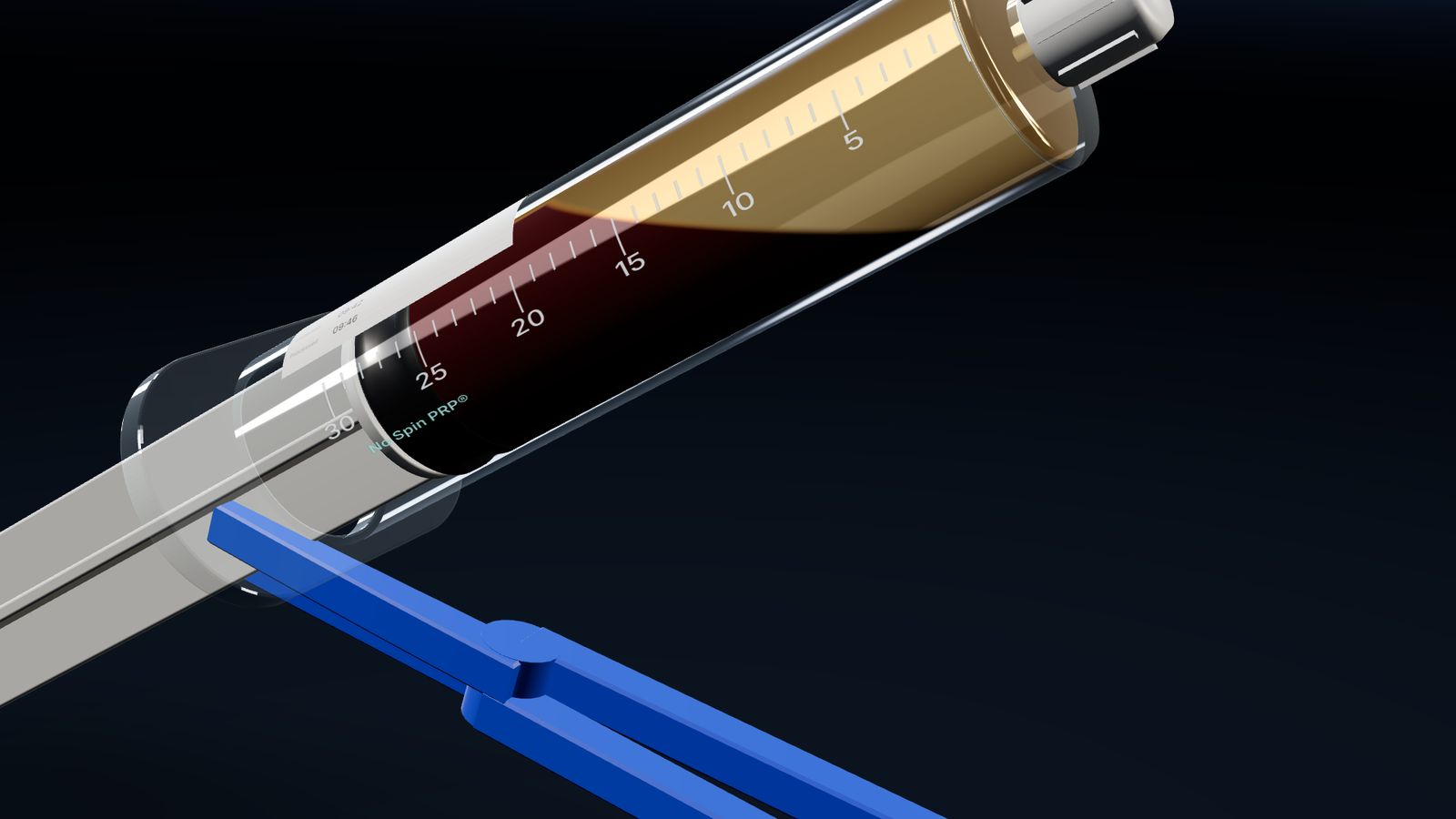 Render: close-up of the processing syringe after settling, a golden plasma layer above the red cells